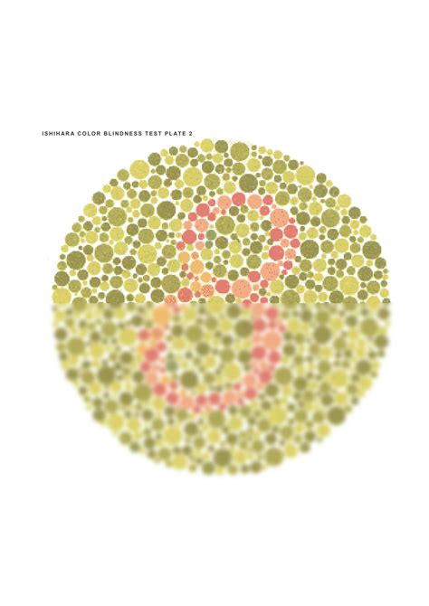 ishihara test score|The Global Health Bureau, Office of Infectious Disease, US .